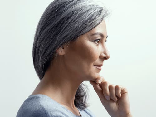 Facelift