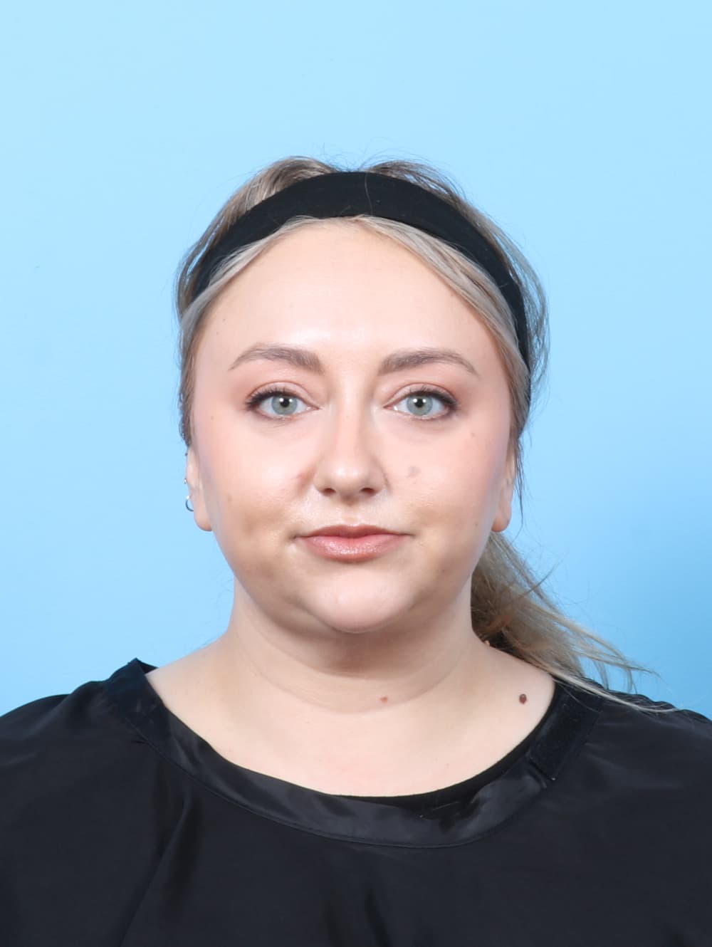 Facial Liposuction case #7686 after, image 1