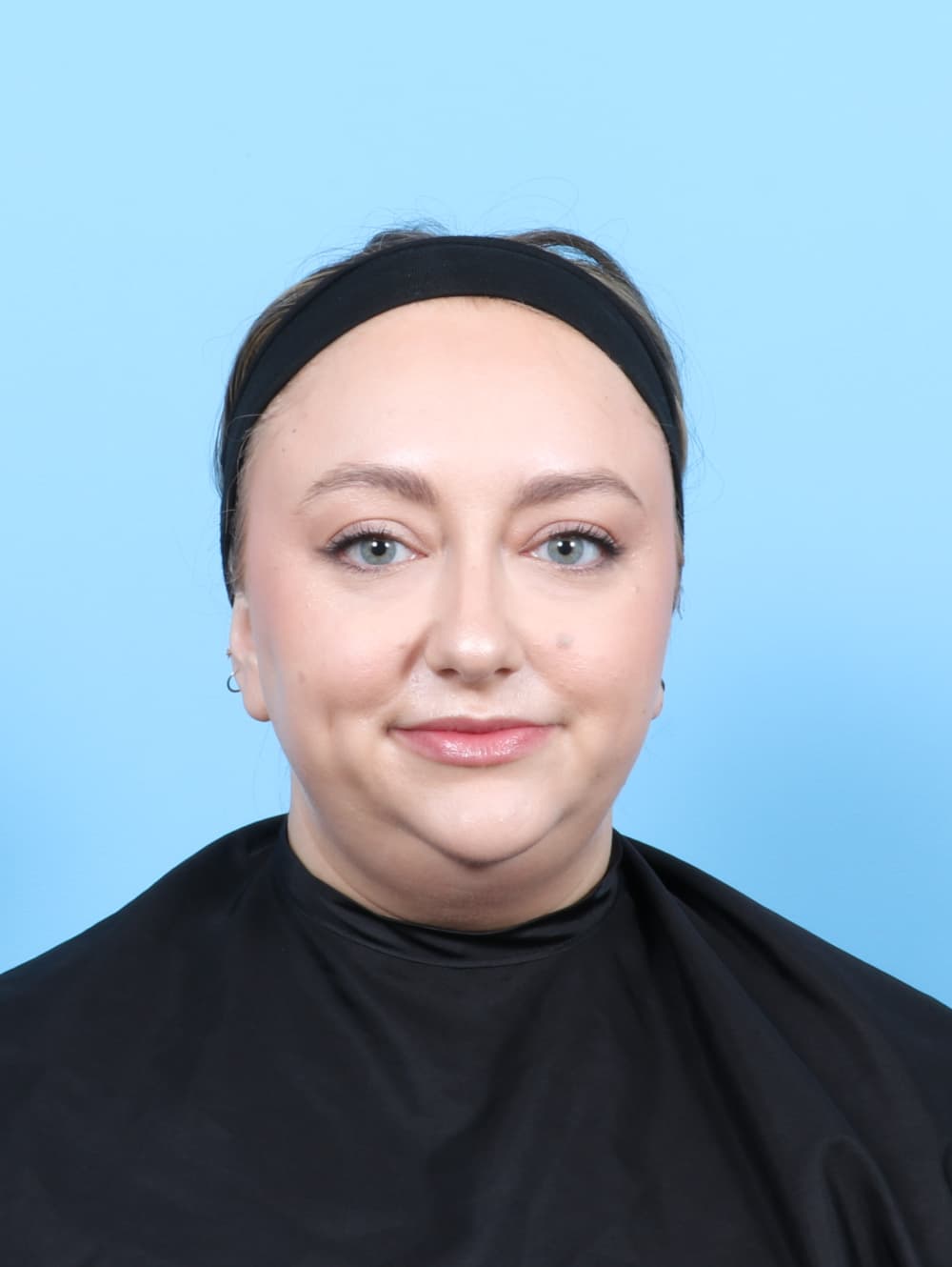 Facial Liposuction case #7686 before, image 1