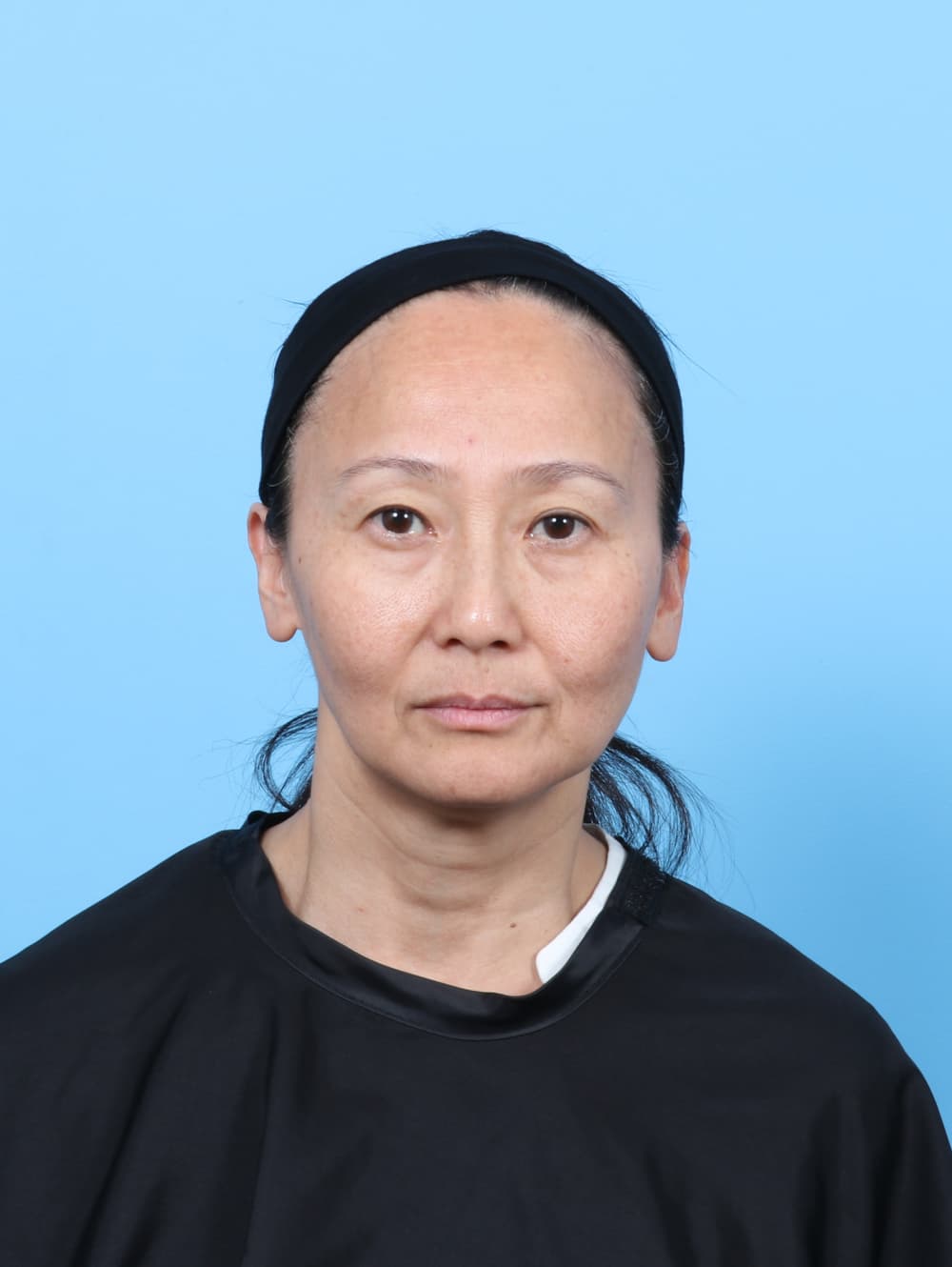 Eyelid Surgery case #7944 before