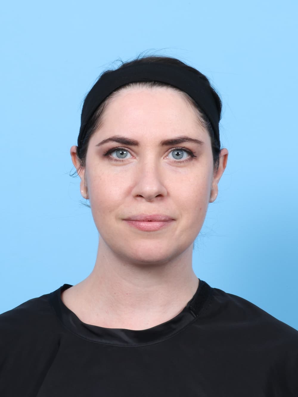 Anterior Neck Lift case #7372 after, image 3