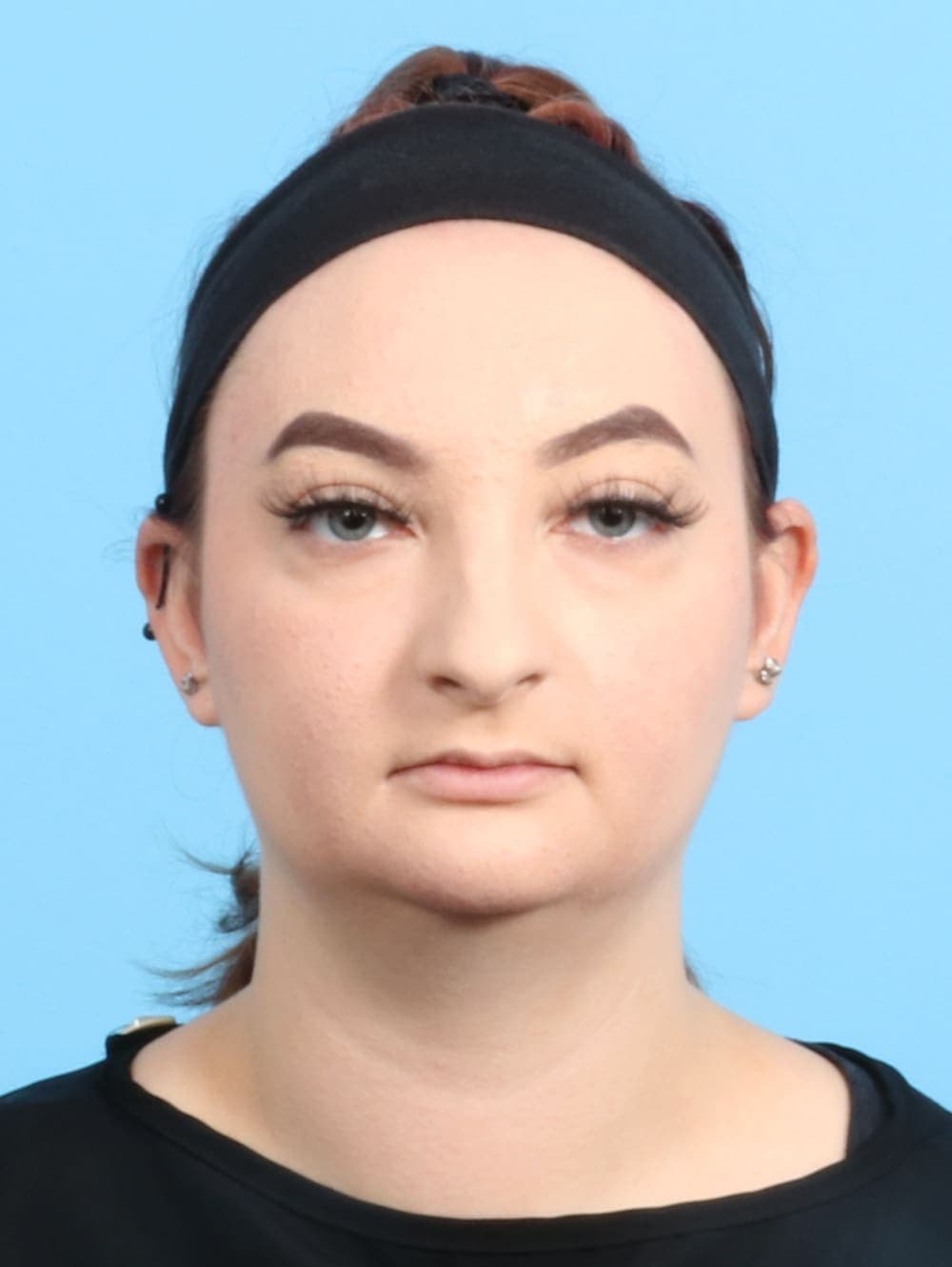 Rhinoplasty case #2528 before, image 2