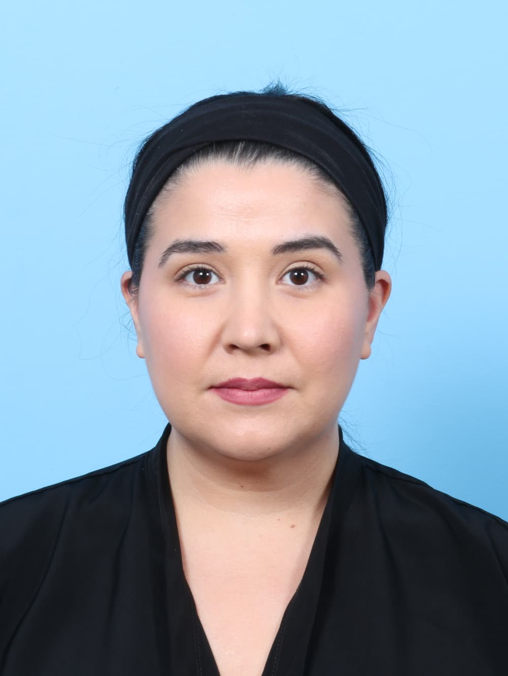 Facial Liposuction case #7897 after, image 1