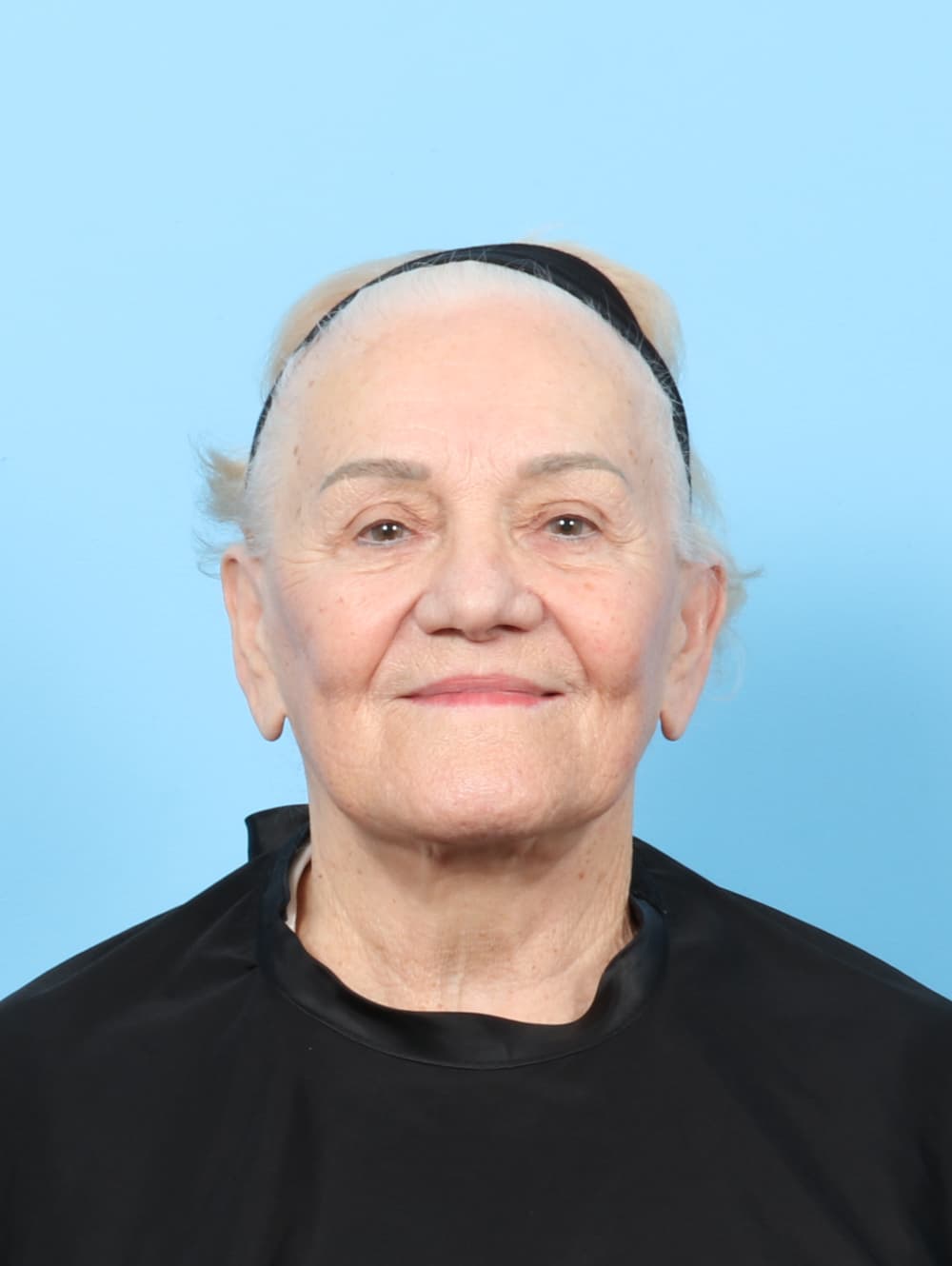 Facelift case #8177 before, image 1