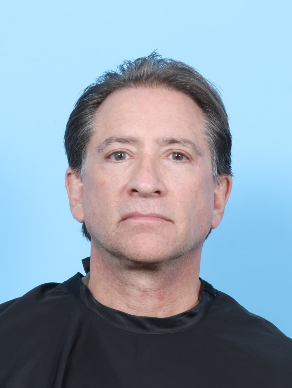 Facelift case #7419 after, image 1