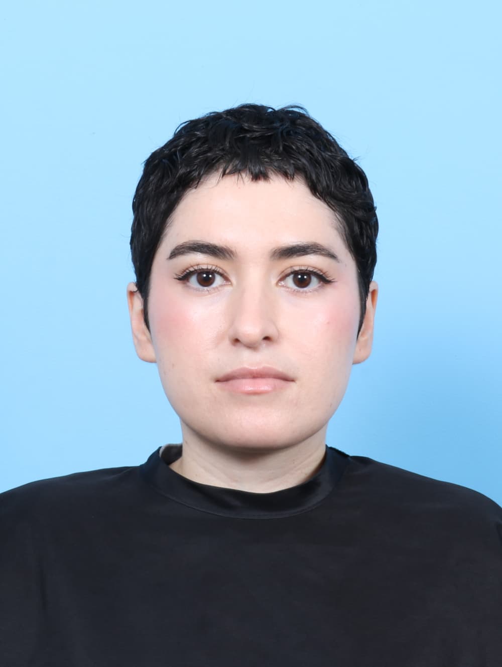 Rhinoplasty case #7668 before, image 2